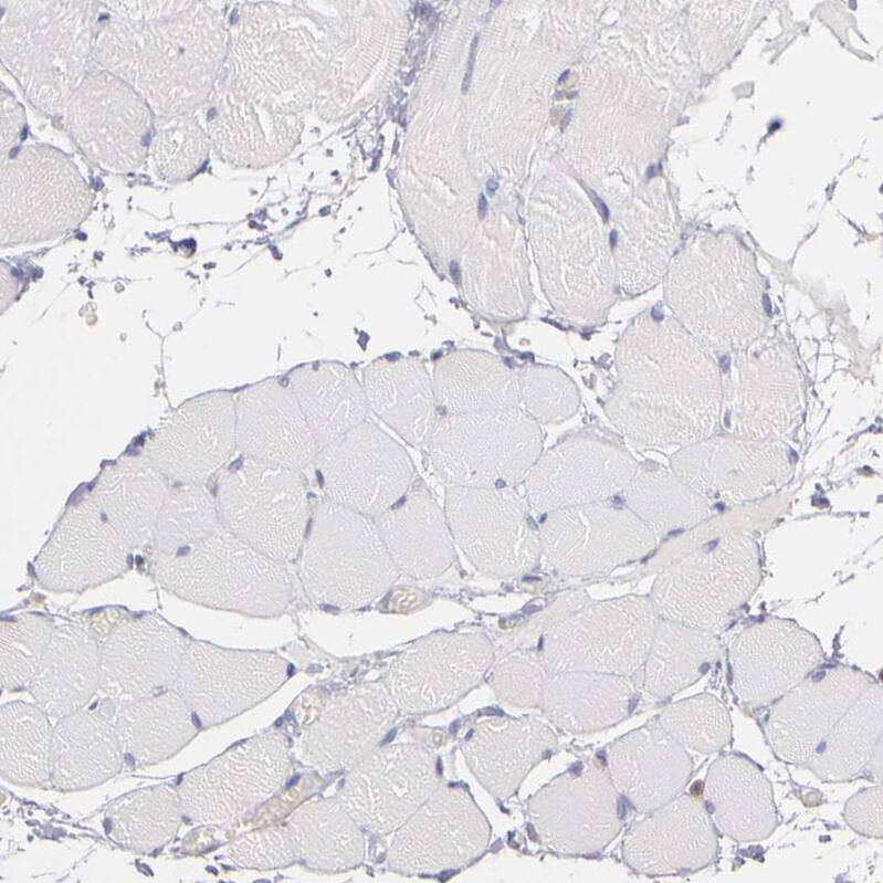 PKC delta Antibody - BSA Free Immunohistochemistry: PKC delta Antibody - BSA Free [NBP1-90351]