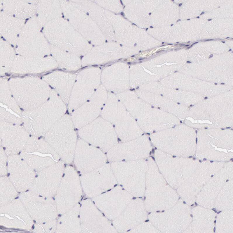 Cytokeratin 18 Antibody - BSA Free Immunohistochemistry: Cytokeratin 18 Antibody - BSA Free [NBP1-90353]