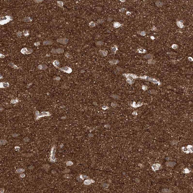 Gemin 5 Antibody - BSA Free Immunohistochemistry: Gemin 5 Antibody - BSA Free [NBP1-90354]