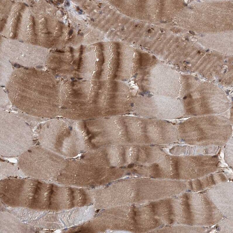 Gemin 5 Antibody - BSA Free Immunohistochemistry: Gemin 5 Antibody - BSA Free [NBP1-90354]