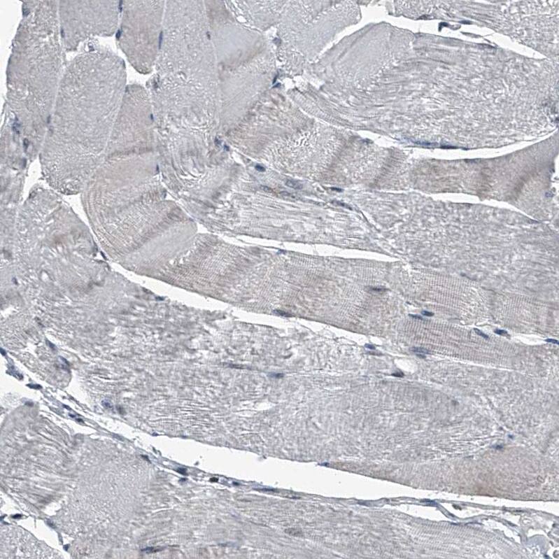 Menin Antibody - BSA Free Immunohistochemistry: Menin Antibody - BSA Free [NBP1-90357]