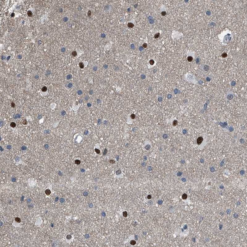 Menin Antibody - BSA Free Immunohistochemistry: Menin Antibody - BSA Free [NBP1-90357]