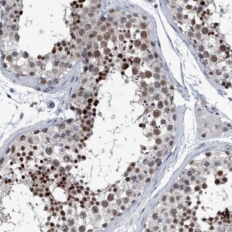 Menin Antibody - BSA Free Immunohistochemistry: Menin Antibody - BSA Free [NBP1-90357]