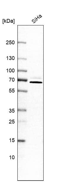 PIP5K1 alpha Antibody - BSA Free Western Blot: PIP5K1 alpha Antibody - BSA Free [NBP1-90358]