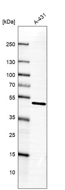 Adenylosuccinate Synthase Antibody - BSA Free Western Blot: Adenylosuccinate Synthase Antibody - BSA Free [NBP1-90360]