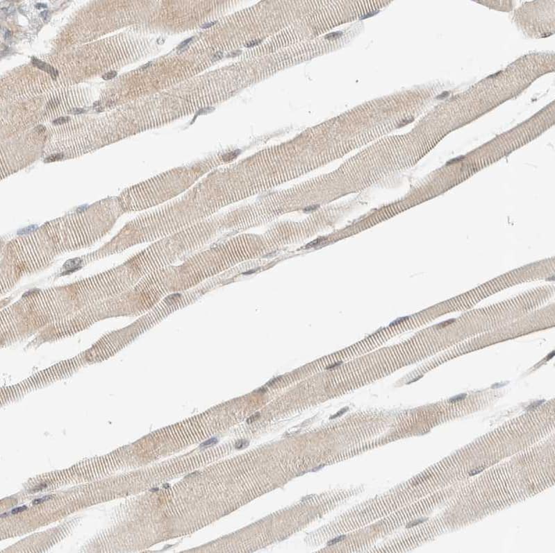 Adenylosuccinate Synthase Antibody - BSA Free Immunohistochemistry: Adenylosuccinate Synthase Antibody - BSA Free [NBP1-90360]