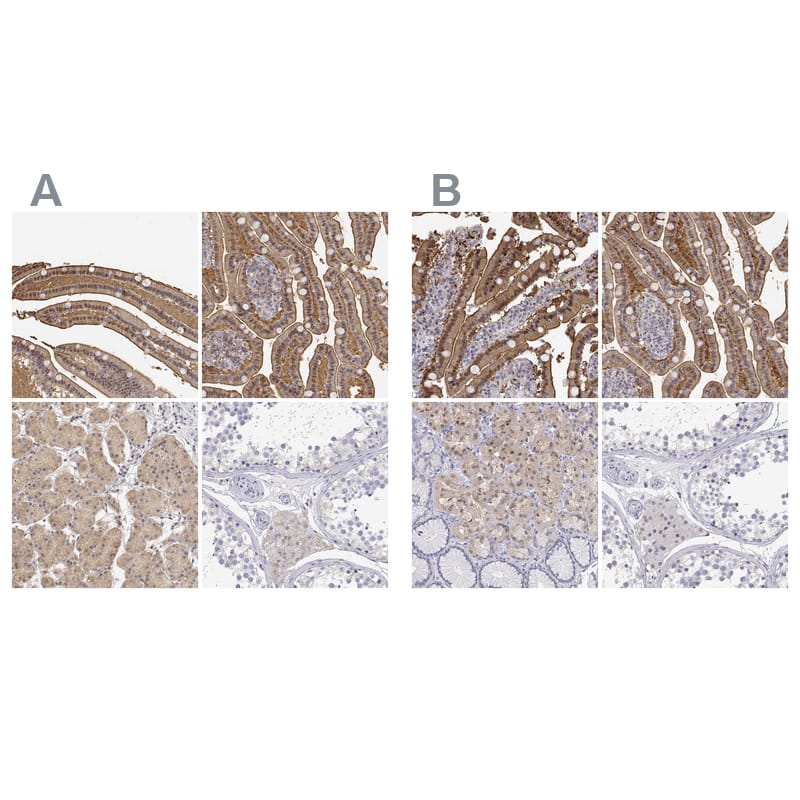 Adenosine Deaminase/ADA Antibody Immunohistochemistry-Paraffin: Adenosine Deaminase/ADA Antibody Antibody [NBP1-90361]