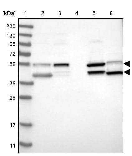 Adenosine Deaminase/ADA Antibody - BSA Free Western Blot: Adenosine Deaminase/ADA Antibody - BSA Free [NBP1-90361]
