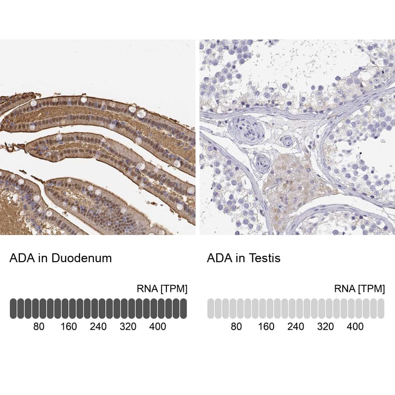 Adenosine Deaminase/ADA Antibody - BSA Free Immunohistochemistry: Adenosine Deaminase/ADA Antibody - BSA Free [NBP1-90361]