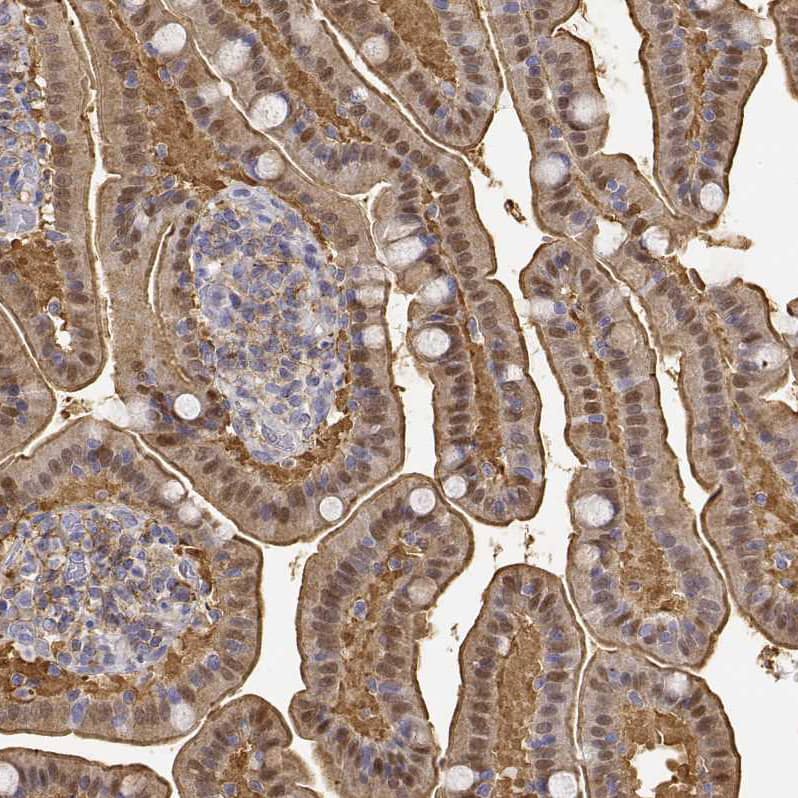 Adenosine Deaminase/ADA Antibody - BSA Free Immunohistochemistry: Adenosine Deaminase/ADA Antibody - BSA Free [NBP1-90361]