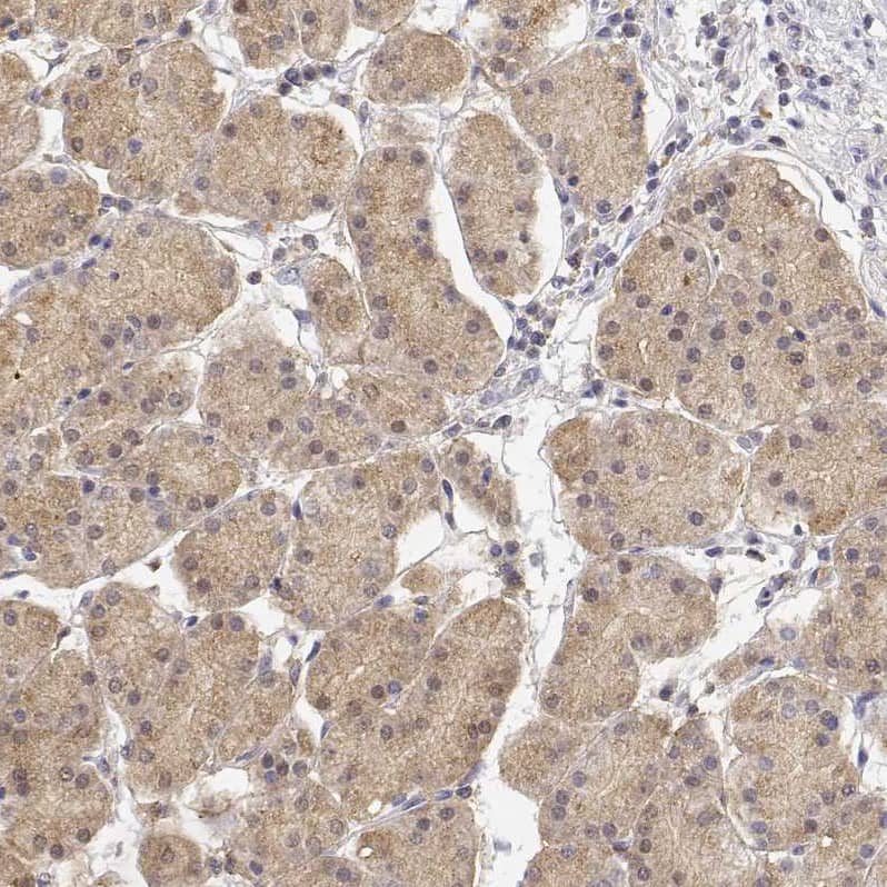 Adenosine Deaminase/ADA Antibody - BSA Free Immunohistochemistry: Adenosine Deaminase/ADA Antibody - BSA Free [NBP1-90361]