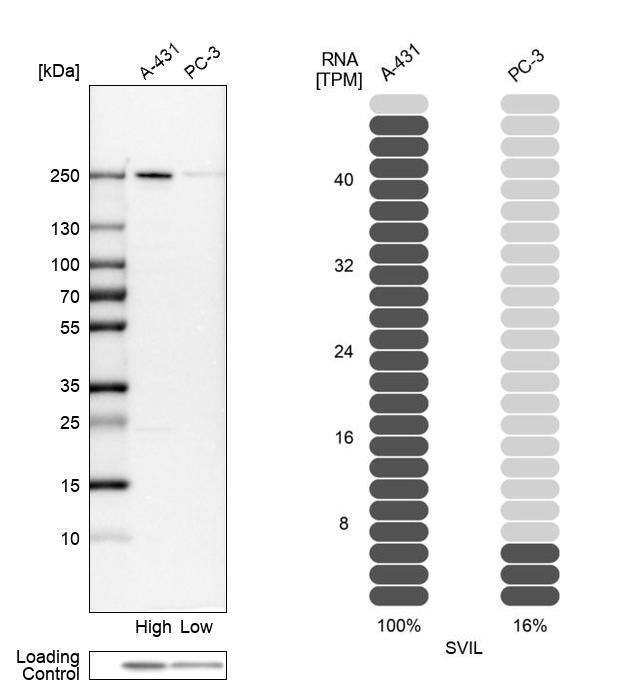 Supervillin Antibody - BSA Free Western Blot: Supervillin Antibody - BSA Free [NBP1-90363]