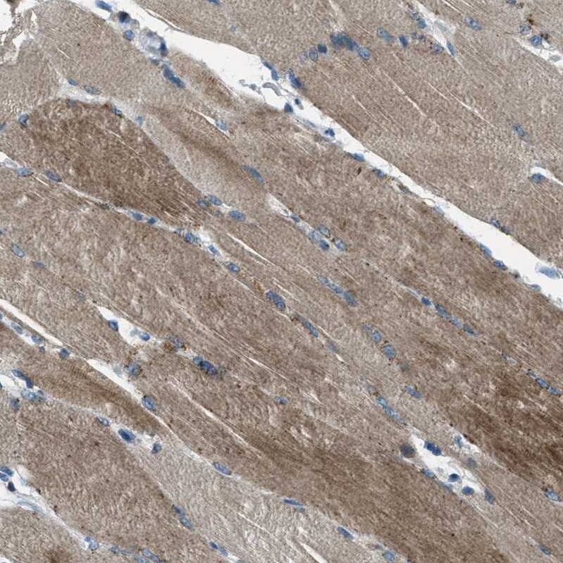 Supervillin Antibody - BSA Free Immunohistochemistry: Supervillin Antibody - BSA Free [NBP1-90363]
