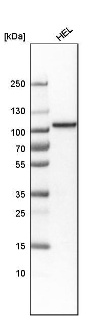 Topoisomerase I Antibody - BSA Free Western Blot: Topoisomerase I Antibody - BSA Free [NBP1-90365]