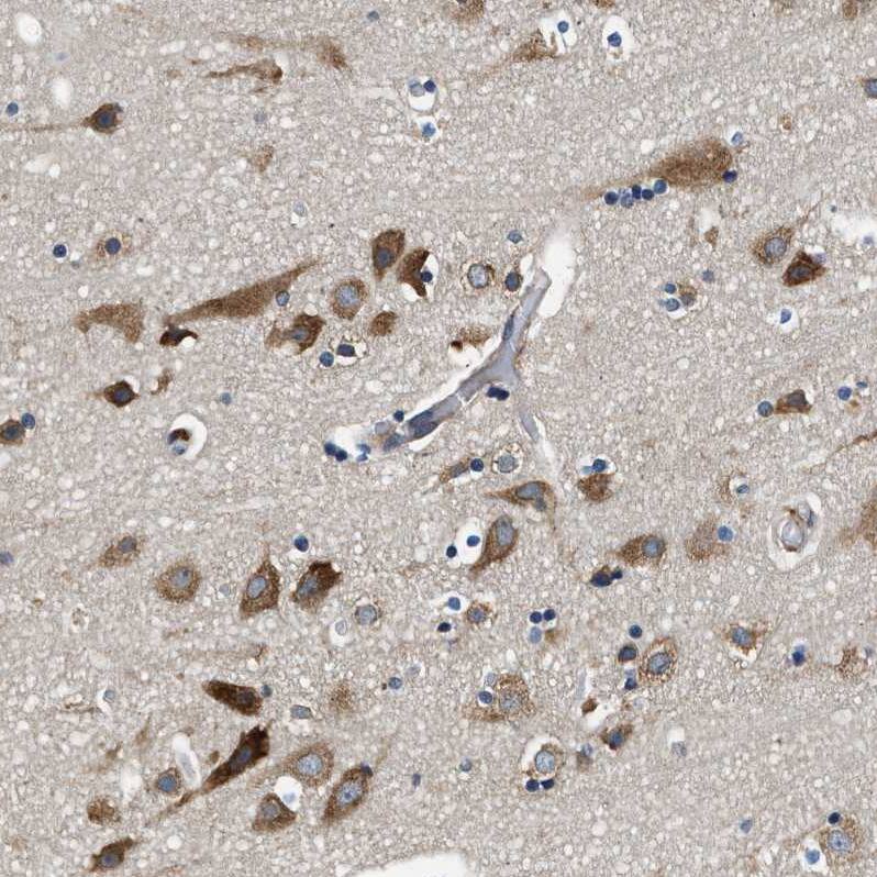 PA2G4/EBP1 Antibody - BSA Free Immunohistochemistry: PA2G4/EBP1 Antibody - BSA Free [NBP1-90369]
