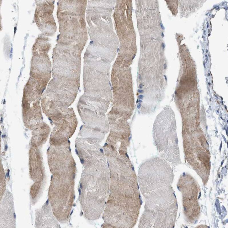 PA2G4/EBP1 Antibody - BSA Free Immunohistochemistry: PA2G4/EBP1 Antibody - BSA Free [NBP1-90369]