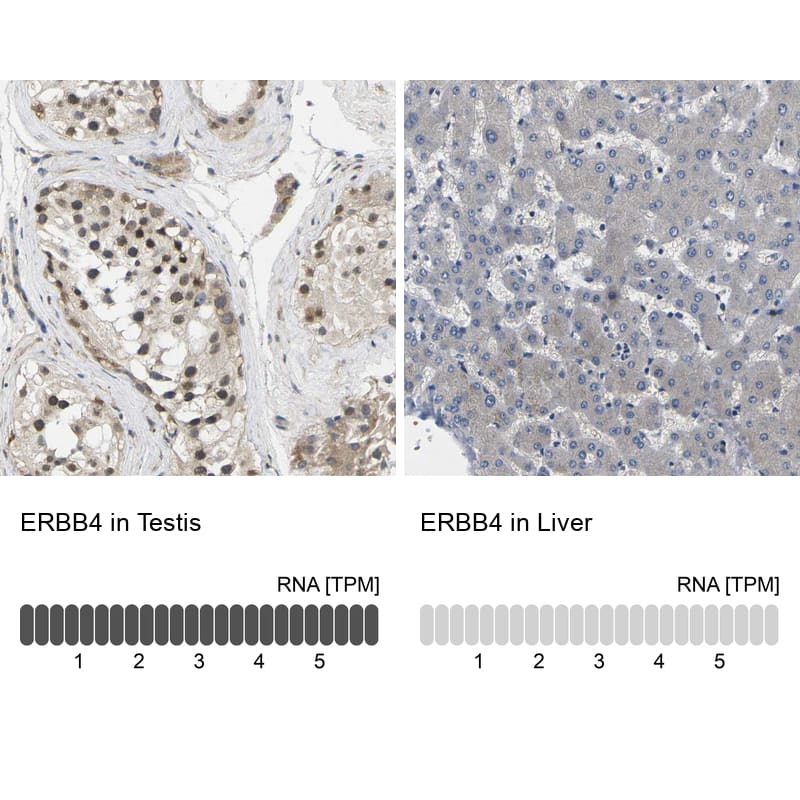 ErbB4/Her4 Antibody - BSA Free Immunohistochemistry: ErbB4/Her4 Antibody - BSA Free [NBP1-90371]