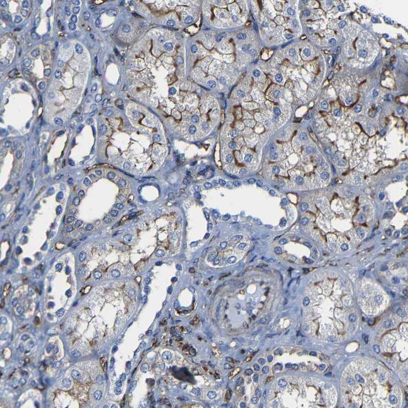 Moesin Antibody - BSA Free Immunohistochemistry: Moesin Antibody - BSA Free [NBP1-90373]
