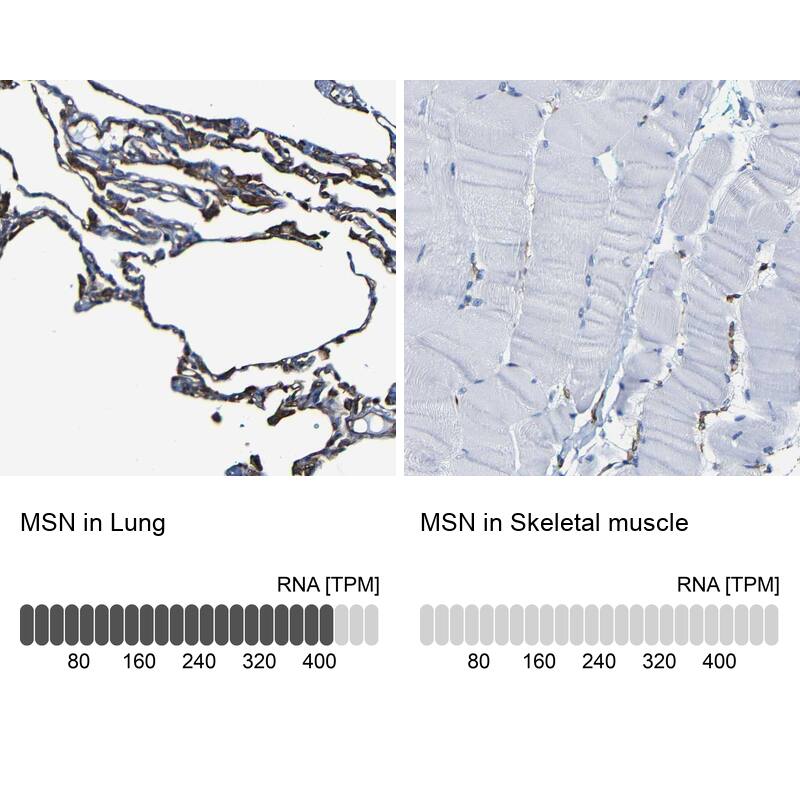 Moesin Antibody - BSA Free Immunohistochemistry: Moesin Antibody - BSA Free [NBP1-90373]