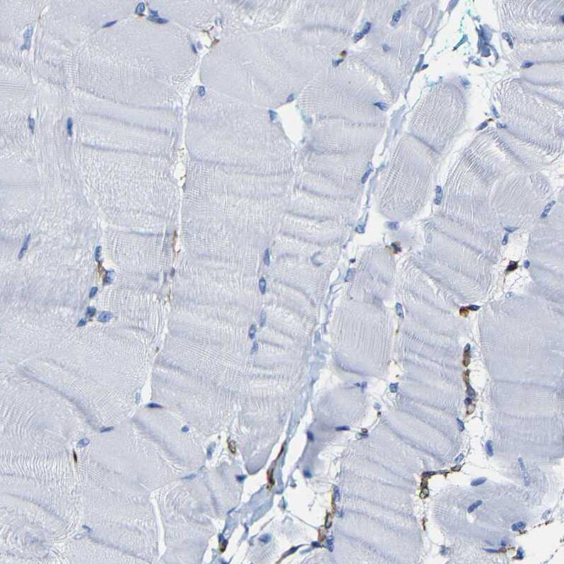 Moesin Antibody - BSA Free Immunohistochemistry: Moesin Antibody - BSA Free [NBP1-90373]
