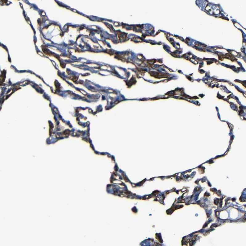 Moesin Antibody - BSA Free Immunohistochemistry: Moesin Antibody - BSA Free [NBP1-90373]