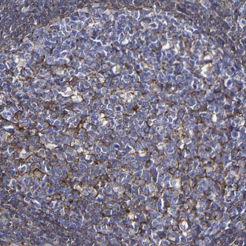 Moesin Antibody - BSA Free Immunohistochemistry: Moesin Antibody - BSA Free [NBP1-90373]