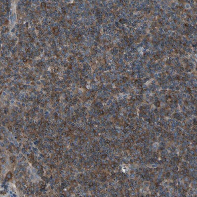 N myc interactor Antibody - BSA Free Immunohistochemistry: N myc interactor Antibody - BSA Free [NBP1-90374]
