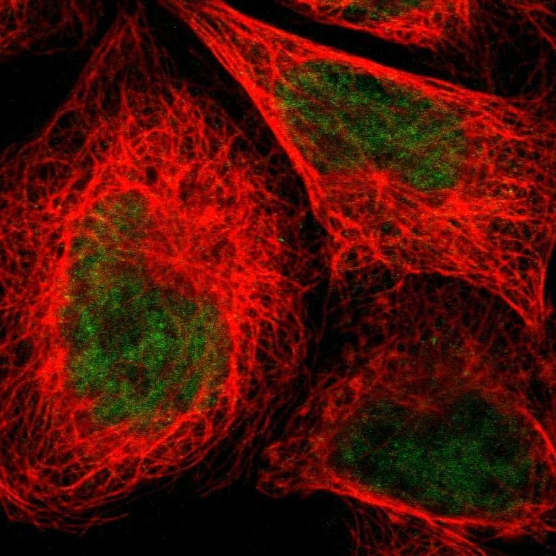 N myc interactor Antibody - BSA Free Immunocytochemistry/ Immunofluorescence: N myc interactor Antibody - BSA Free [NBP1-90374]
