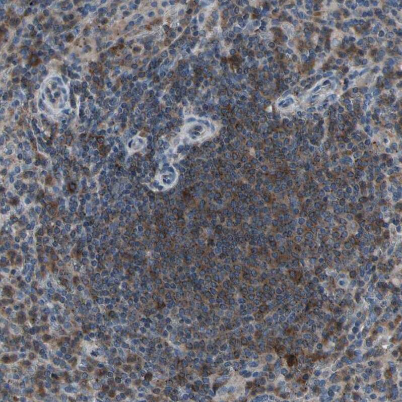 N myc interactor Antibody - BSA Free Immunohistochemistry: N myc interactor Antibody - BSA Free [NBP1-90374]