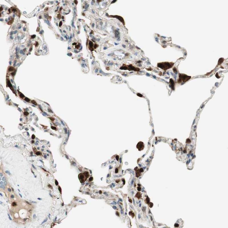 Leukotriene A4 Hydrolase/LTA4H Antibody - BSA Free Immunohistochemistry: Leukotriene A4 Hydrolase/LTA4H Antibody - BSA Free [NBP1-90375]