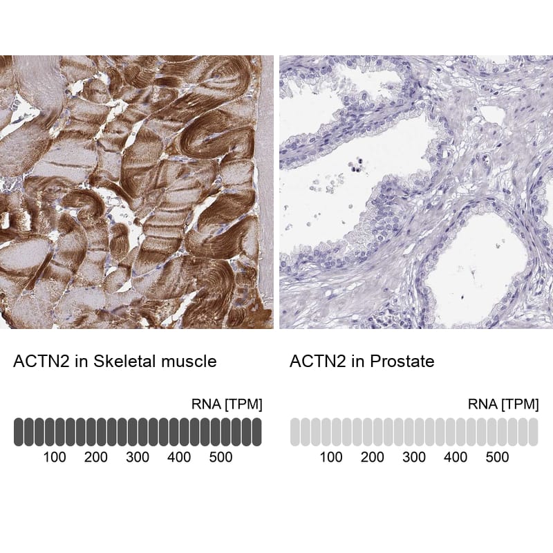 Alpha Actinin 2 Antibody - BSA Free Immunohistochemistry: Alpha Actinin 2 Antibody - BSA Free [NBP1-90376]