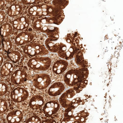 RESF1 Antibody - BSA Free Immunohistochemistry: RESF1 Antibody - BSA Free [NBP1-90428]