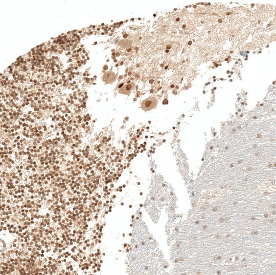 RESF1 Antibody - BSA Free Immunohistochemistry: RESF1 Antibody - BSA Free [NBP1-90428]