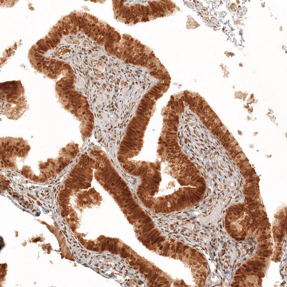 RESF1 Antibody - BSA Free Immunohistochemistry: RESF1 Antibody - BSA Free [NBP1-90428]