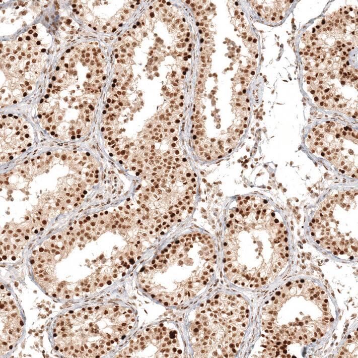 RESF1 Antibody - BSA Free Immunohistochemistry: RESF1 Antibody - BSA Free [NBP1-90428]