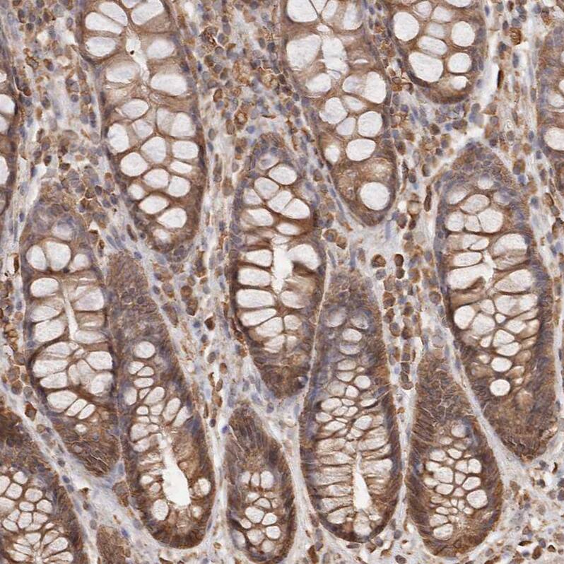 ARHGEF10L Antibody - BSA Free Immunohistochemistry: ARHGEF10L Antibody - BSA Free [NBP1-90431]