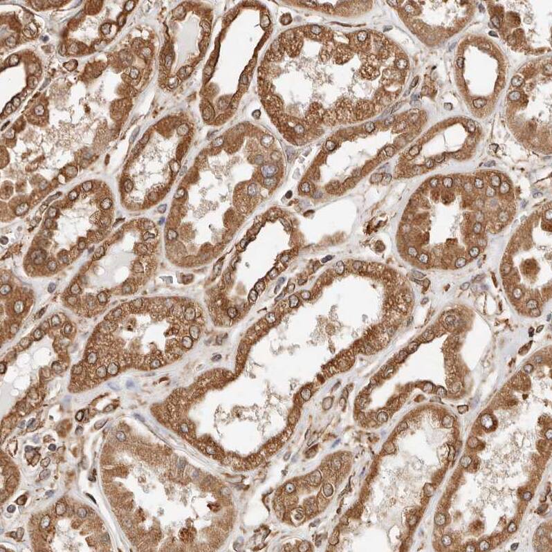 ARHGEF10L Antibody - BSA Free Immunohistochemistry: ARHGEF10L Antibody - BSA Free [NBP1-90431]