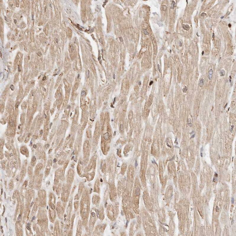 ARHGEF10L Antibody - BSA Free Immunohistochemistry: ARHGEF10L Antibody - BSA Free [NBP1-90431]