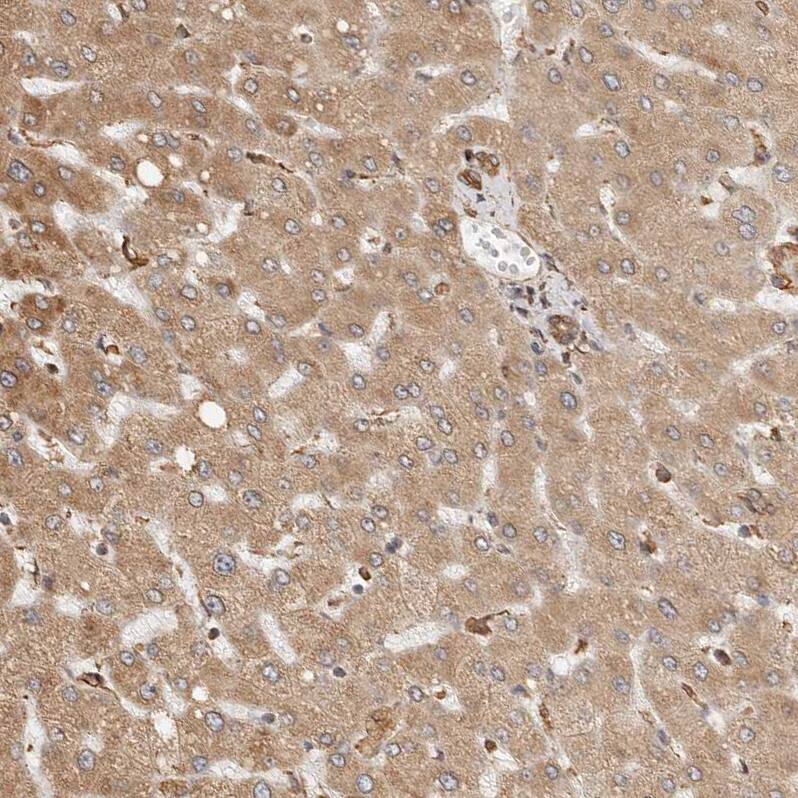 ARHGEF10L Antibody - BSA Free Immunohistochemistry: ARHGEF10L Antibody - BSA Free [NBP1-90431]