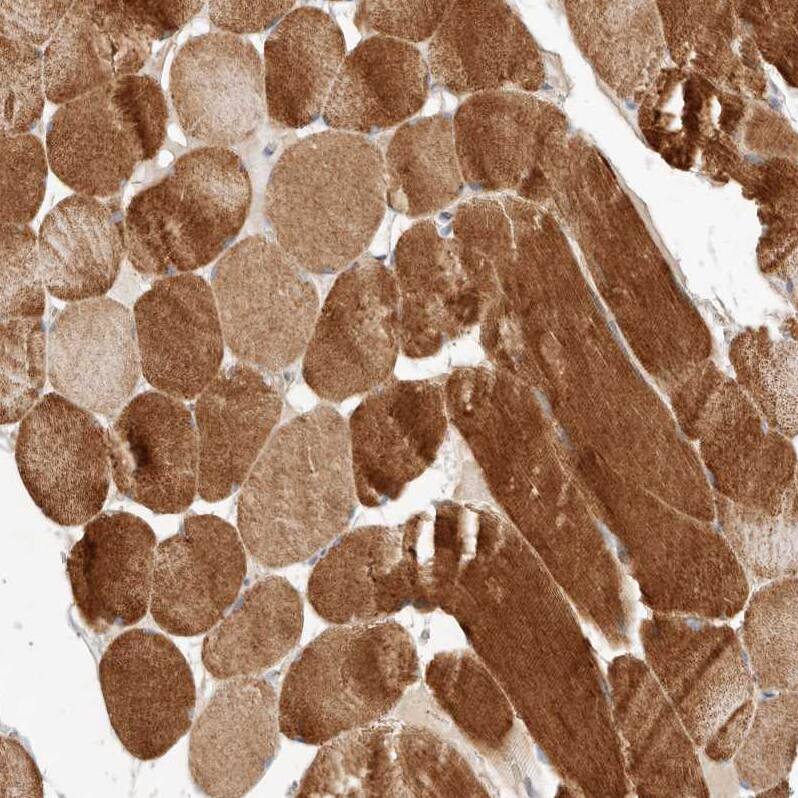 ARHGEF10L Antibody - BSA Free Immunohistochemistry: ARHGEF10L Antibody - BSA Free [NBP1-90433]