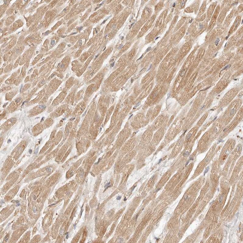 ARHGEF10L Antibody - BSA Free Immunohistochemistry: ARHGEF10L Antibody - BSA Free [NBP1-90433]