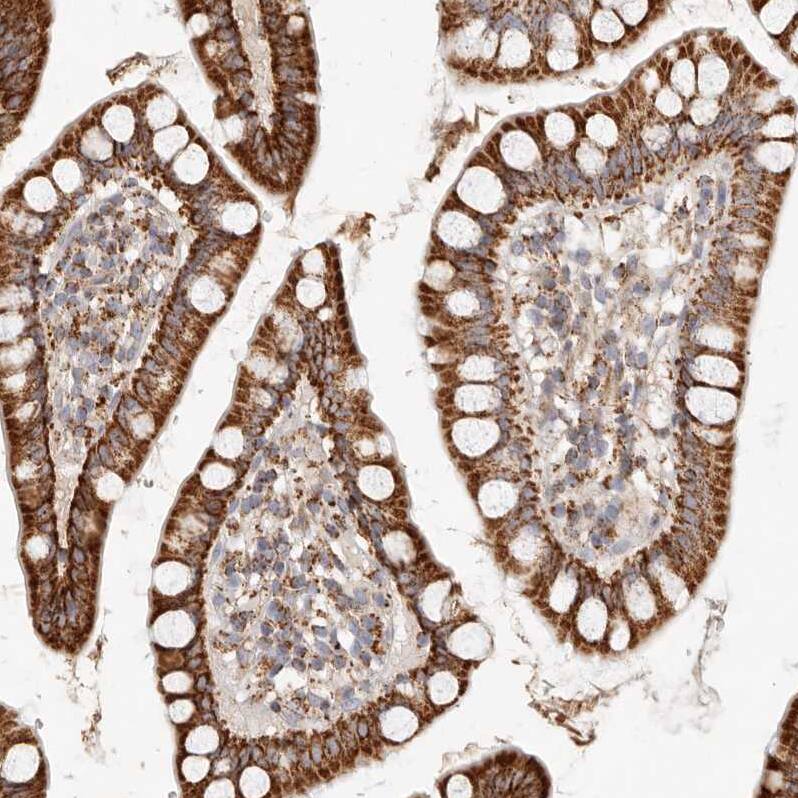 ARHGEF10L Antibody - BSA Free Immunohistochemistry: ARHGEF10L Antibody - BSA Free [NBP1-90433]