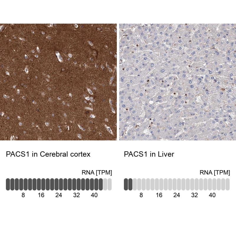 PACS1 Antibody - BSA Free Immunohistochemistry: PACS1 Antibody - BSA Free [NBP1-90439]