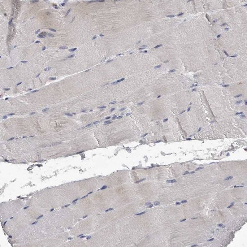 KIF26B Antibody - BSA Free Immunohistochemistry: KIF26B Antibody - BSA Free [NBP1-90446]