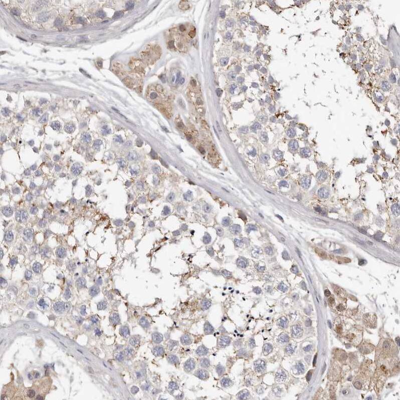 KIF26B Antibody - BSA Free Immunohistochemistry: KIF26B Antibody - BSA Free [NBP1-90446]