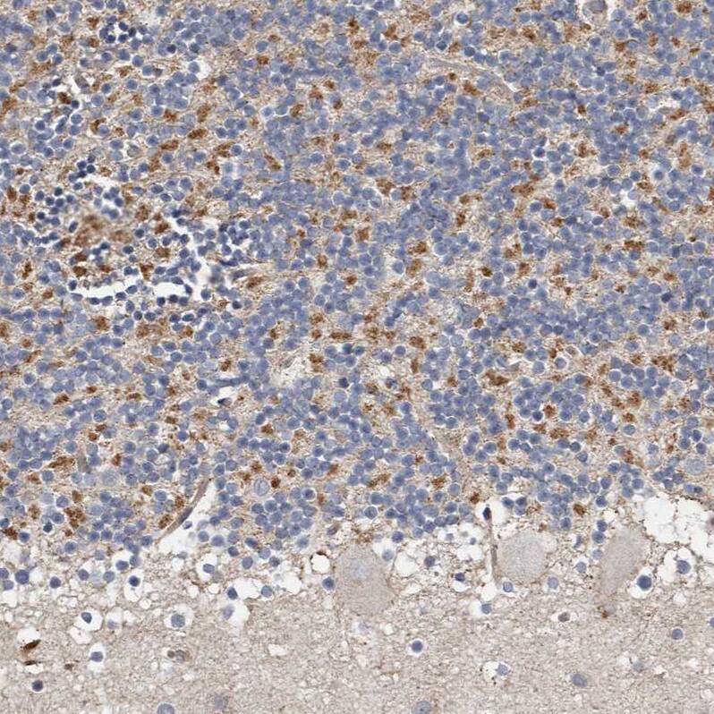 KIF26B Antibody - BSA Free Immunohistochemistry: KIF26B Antibody - BSA Free [NBP1-90446]