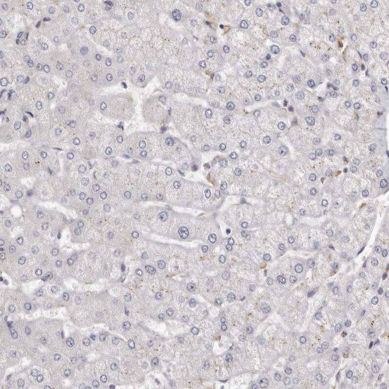 KIF26B Antibody - BSA Free Immunohistochemistry: KIF26B Antibody - BSA Free [NBP1-90446]