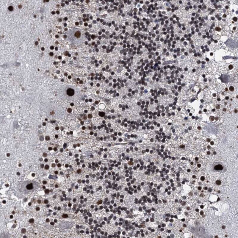 RUFY2 Antibody - BSA Free Immunohistochemistry-Paraffin: RUFY2 Antibody [NBP1-90448]