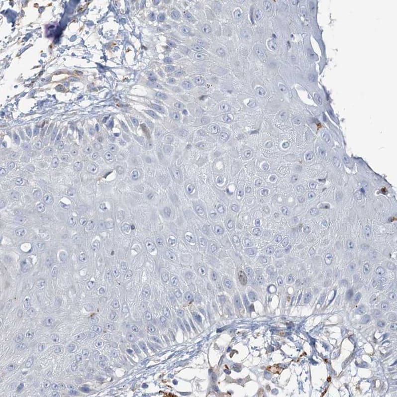 PEAR1 Antibody - BSA Free Immunohistochemistry: PEAR1 Antibody - BSA Free [NBP1-90449]