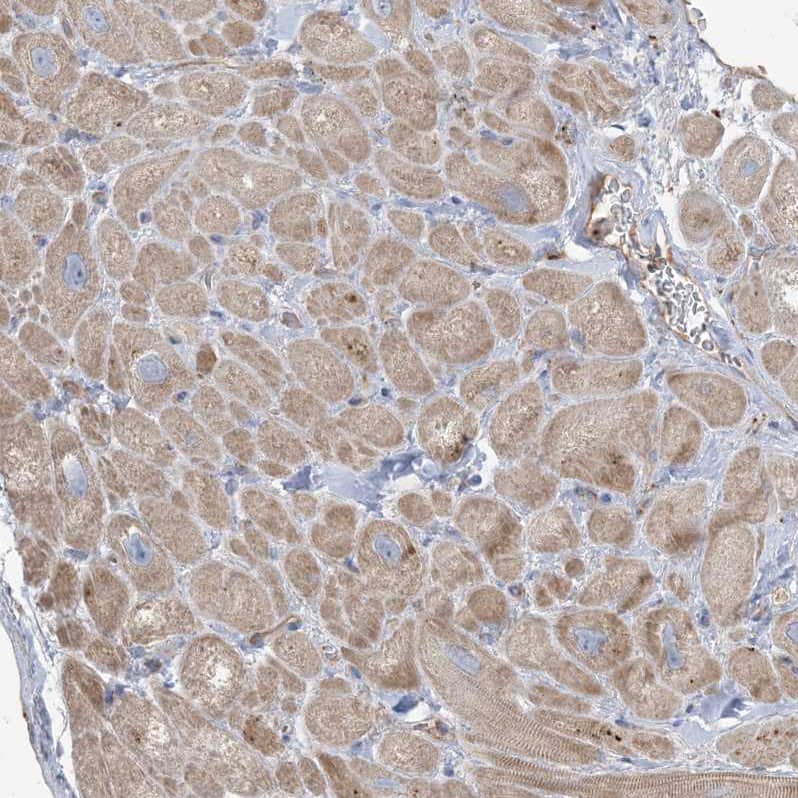 PEAR1 Antibody - BSA Free Immunohistochemistry: PEAR1 Antibody - BSA Free [NBP1-90449]
